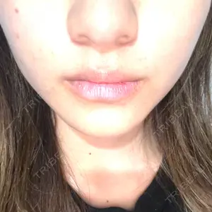 口コミ