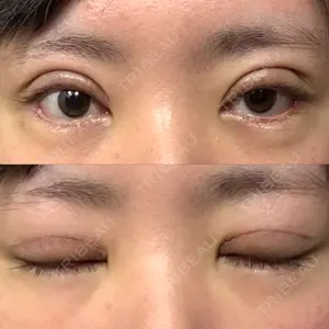 オーキッド美容クリニック東京御徒町口コミ