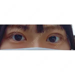 東京シンデレラ美容外科 東京シンデレラ美容外科 大宮院口コミ
