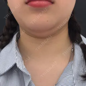 口コミ