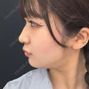口コミ