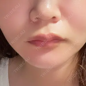 BIZENNクリニック【ビゼンクリニック】口コミ