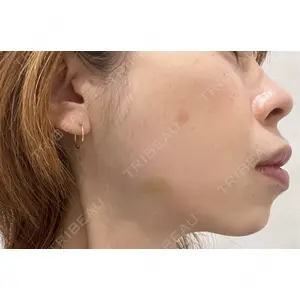 フォンタナクリニック天神口コミ