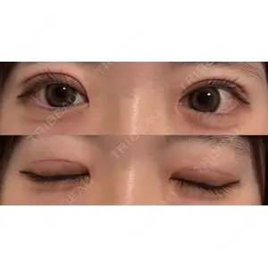 オーキッド美容クリニック東京御徒町口コミ