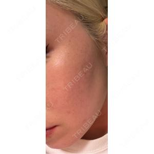 BITO BEAUTY CLINIC BITO BEAUTY CLINIC口コミ