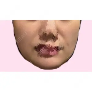 4Dクリニック口コミ