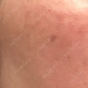 おおかみ美容のクリニック おおかみ美容のクリニック 横浜院口コミ
