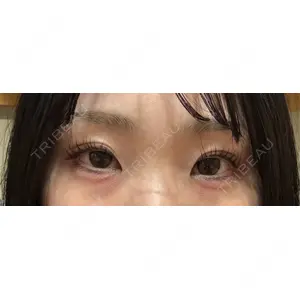 口コミ