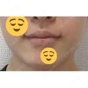 口コミ