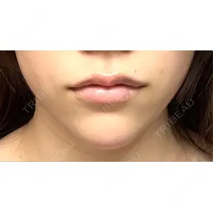 L‘amour clinic Tokyo【ラムールクリニック東京】の