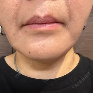 口コミ