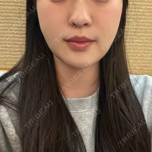 口コミ