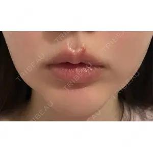 藤・ナチュレ美容クリニック 藤・ナチュレ美容クリニック 銀座院口コミ