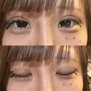 口コミ