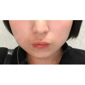 医療法人社団 純栄会 ジュエルクリニック 恵比寿院口コミ