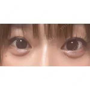 フィラークリニック フィラークリニック 大阪心斎橋院口コミ