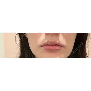 口コミ