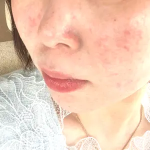 ルラ美容クリニック ルラ美容クリニック 広島院口コミ