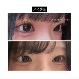 口コミ