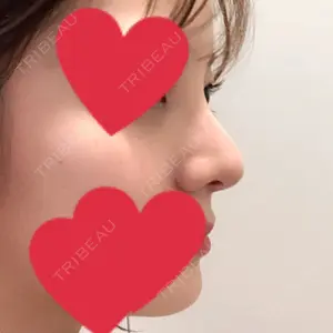 HANABI整形外科口コミ