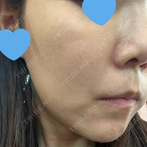 AURORA CLINIC（オーロラクリニック）新宿院口コミ