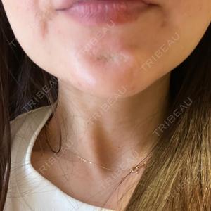 AB美容クリニック AB美容クリニック 新宿院口コミ