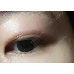 表参道スキンクリニック 表参道スキンクリニック 表参道院口コミ