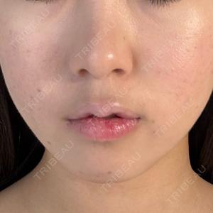 BITO BEAUTY CLINIC BITO BEAUTY CLINIC口コミ