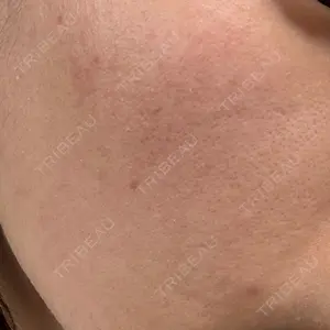 HAAB CLINIC HAAB CLINIC 池袋院口コミ