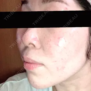 ルラ美容クリニック ルラ美容クリニック 広島院口コミ