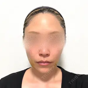 口コミ