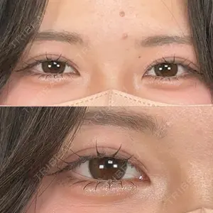口コミ