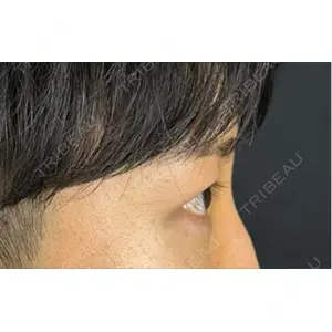 藤・ナチュレ美容クリニック 藤・ナチュレ美容クリニック 銀座院口コミ