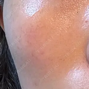 おおかみ美容のクリニック おおかみ美容のクリニック 横浜院口コミ