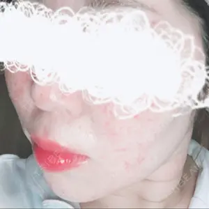 ルラ美容クリニック ルラ美容クリニック 広島院口コミ