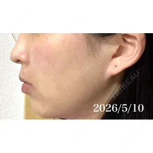 ルラ美容クリニック ルラ美容クリニック 新潟院口コミ