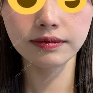 口コミ