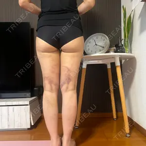 Lipo Clinic omotesando口コミ