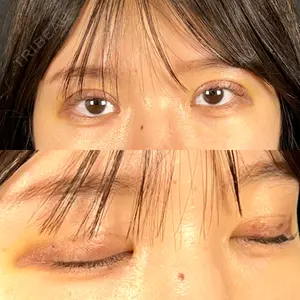 藤・ナチュレ美容クリニック 藤・ナチュレ美容クリニック 銀座院口コミ