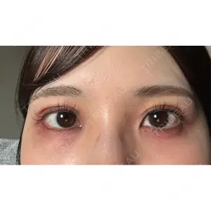 東京イセアクリニック口コミ