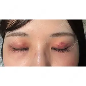 東京イセアクリニック口コミ