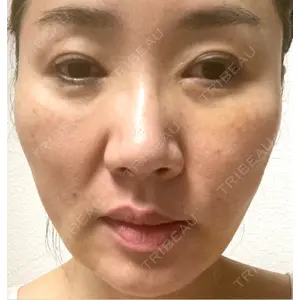 Nebula Clinic 札幌美容外科ネビュラクリニック口コミ