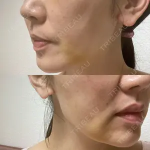 Nebula Clinic 札幌美容外科ネビュラクリニック口コミ