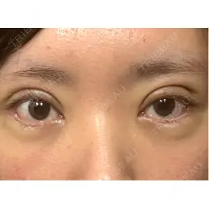 オーキッド美容クリニック東京御徒町口コミ