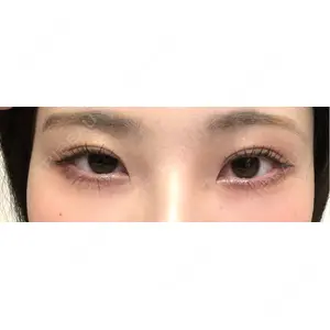 東京イセアクリニック口コミ
