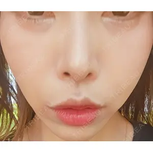 口コミ