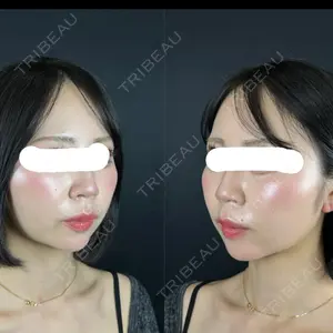 藤・ナチュレ美容クリニック 藤・ナチュレ美容クリニック 銀座院口コミ