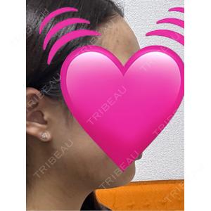 ARTE BEAUTY CLINIC口コミ