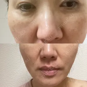 Nebula Clinic 札幌美容外科ネビュラクリニック口コミ