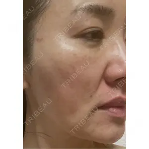 Nebula Clinic 札幌美容外科ネビュラクリニック口コミ